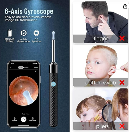 Zynovio Pro™ - Advanced Ear Wax Remover